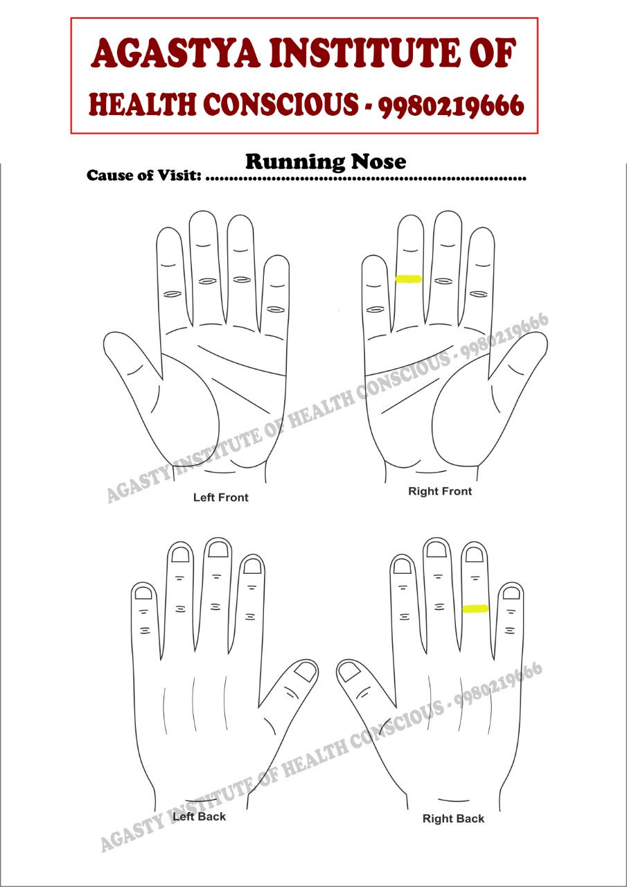 Running Nose