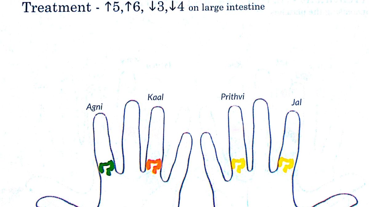 IBS - Irritable Bowel Syndrome