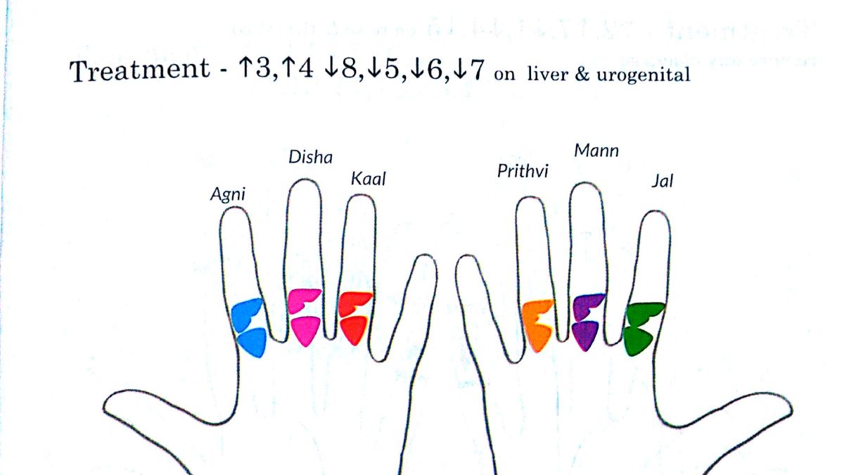 Spotting (Scanty) Periods