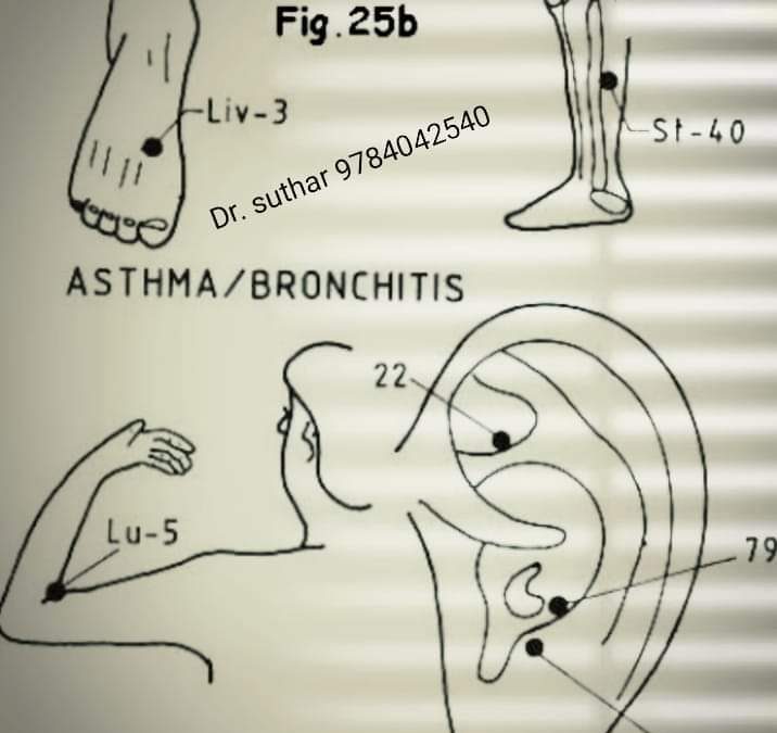 Asthma_Bronchitis_2