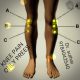 Knee Pain Points